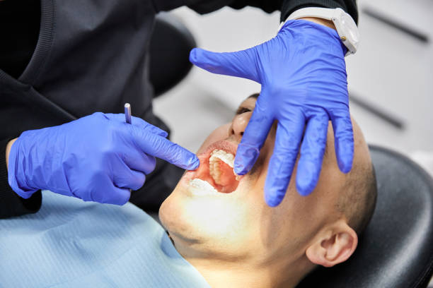 Best Knocked-Out Tooth (Avulsed Tooth) Treatment in Navarre, OH